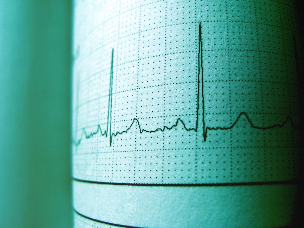 pexels-photo-1093161-1093161-1 Close-up of an ECG printout displaying heartbeat rhythm and frequency for medical analysis.