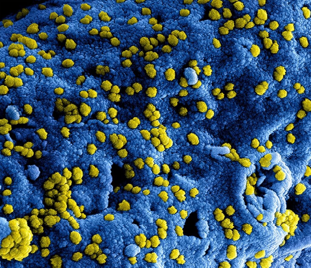 Microscopic view of yellow virus particles on a blue surface, showcasing intricate details.